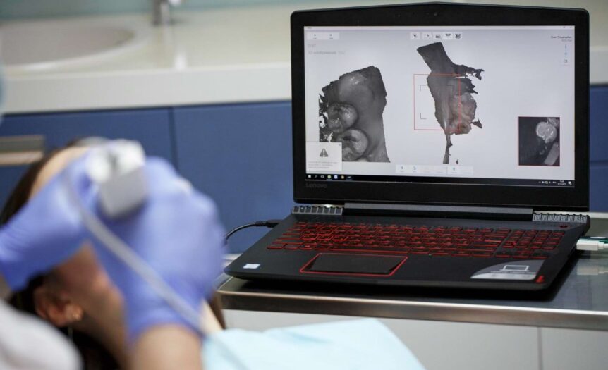 ultrasonografy przenośne