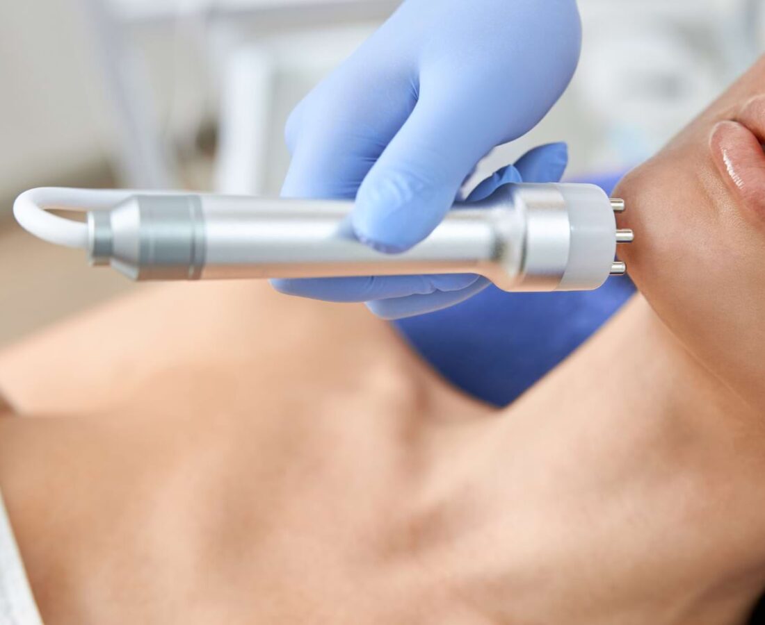 radiofrekwencja mikroigłowa