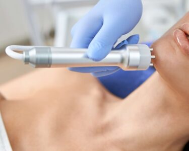 radiofrekwencja mikroigłowa