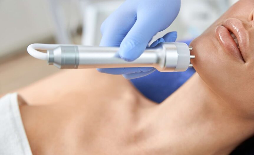 radiofrekwencja mikroigłowa